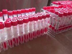 Peningkatan jumlah pemeriksaan PCR Covid-19 dan screening Malaria di Kota Jayapura