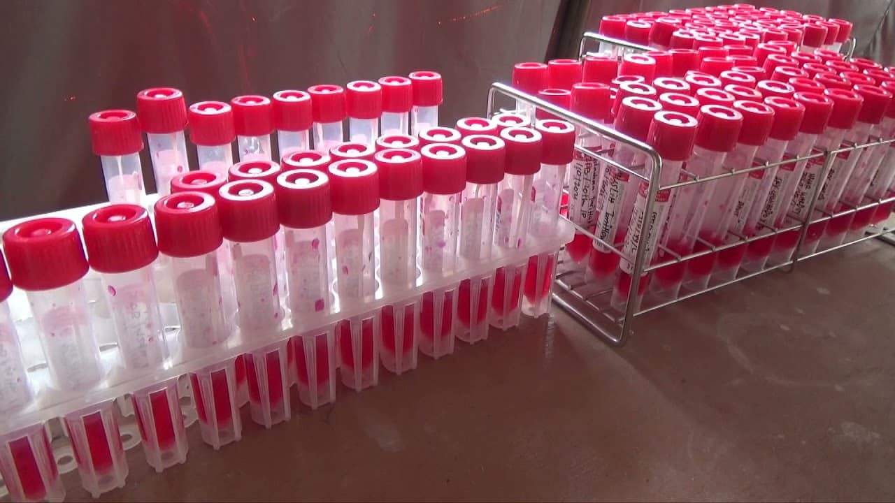  Peningkatan jumlah pemeriksaan PCR Covid-19 dan screening Malaria di Kota Jayapura