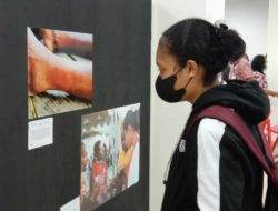 Kisah para penderita kusta di Papua